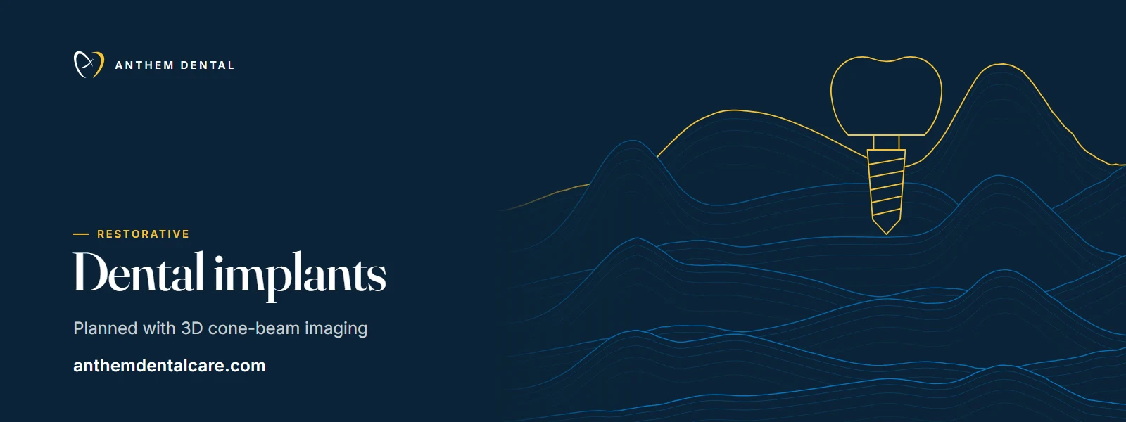 Illustrated night-blue banner of flowing contour lines for Anthem Dental, dental implants page