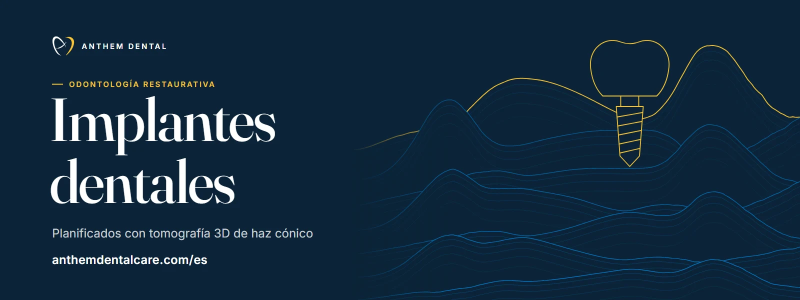 Banner ilustrado en azul noche con líneas de contorno de Anthem Dental, página de implantes dentales