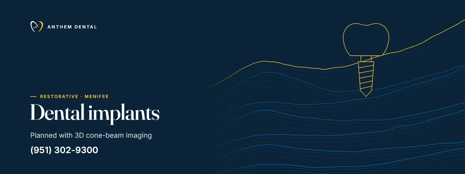 Illustrated night-blue banner of flowing contour lines for Anthem Dental Menifee, dental implants page
