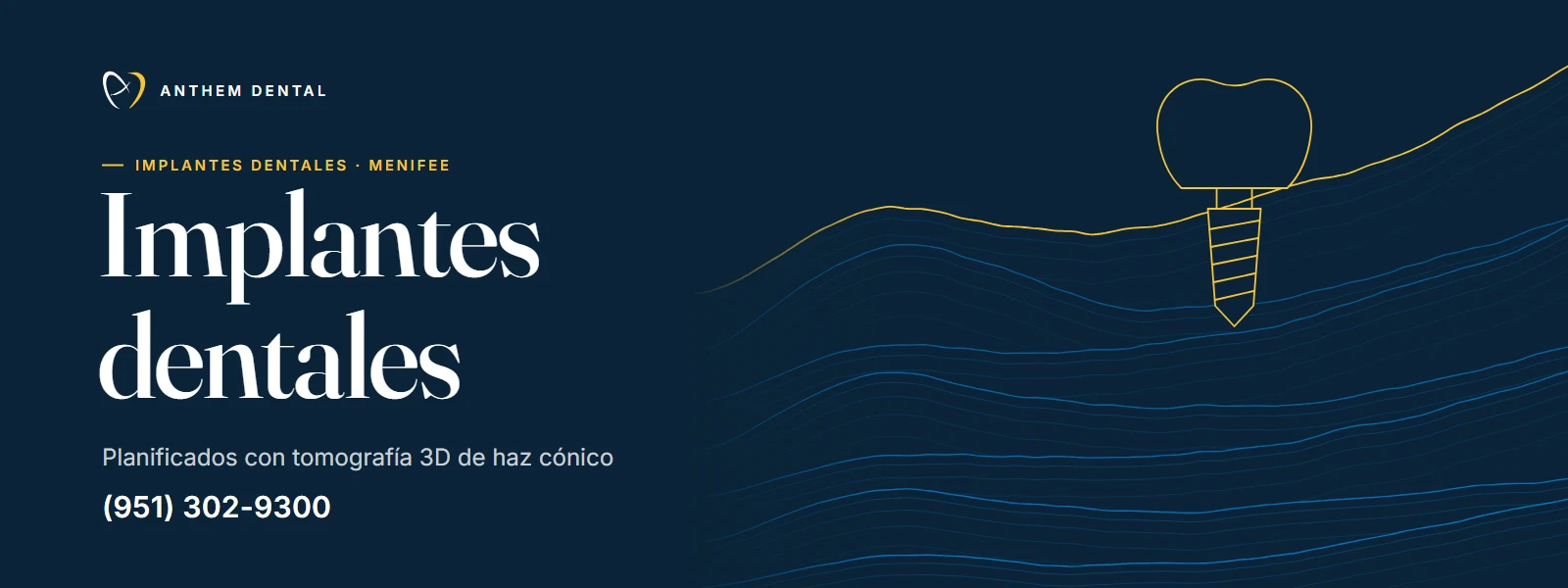 Banner ilustrado en azul noche con líneas de contorno de Anthem Dental Menifee, página de implantes dentales