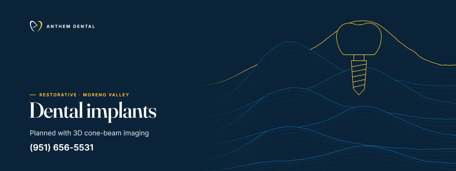 Illustrated night-blue banner of flowing contour lines for Anthem Dental Moreno Valley, dental implants page