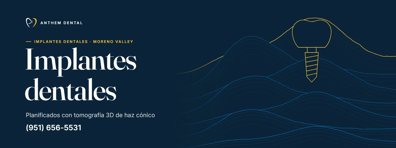 Banner ilustrado en azul noche con líneas de contorno de Anthem Dental Moreno Valley, página de implantes dentales