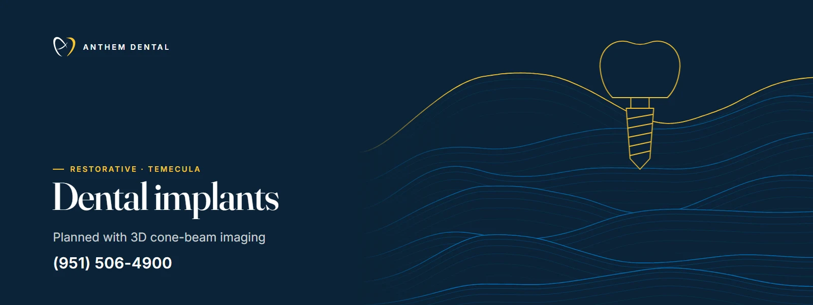 Illustrated night-blue banner of flowing contour lines for Anthem Dental Temecula, dental implants page