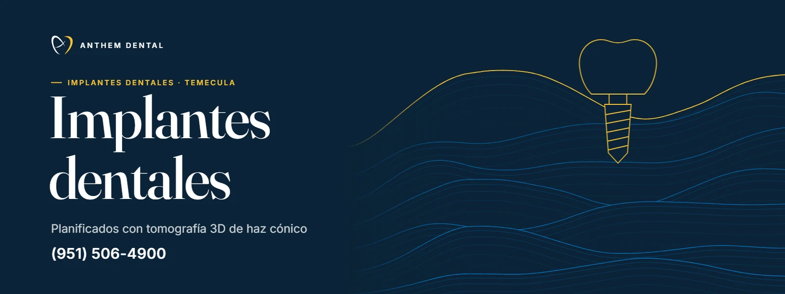 Banner ilustrado en azul noche con líneas de contorno de Anthem Dental Temecula, página de implantes dentales