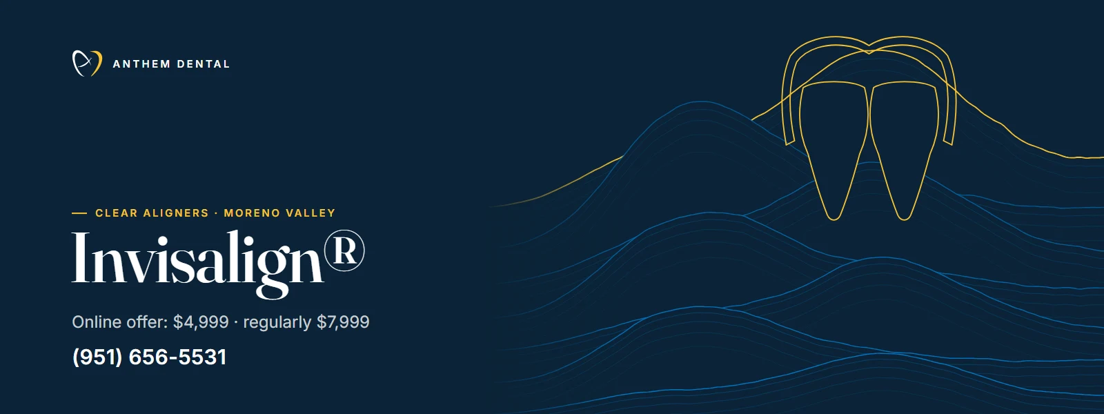 Illustrated night-blue banner of flowing contour lines for Anthem Dental Moreno Valley, clear aligners page