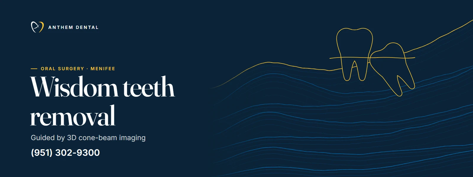 Illustrated night-blue banner of flowing contour lines for Anthem Dental Menifee, wisdom teeth page