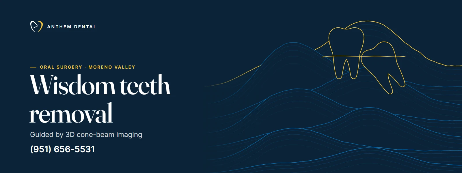 Illustrated night-blue banner of flowing contour lines for Anthem Dental Moreno Valley, wisdom teeth page