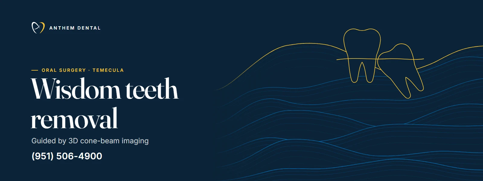 Illustrated night-blue banner of flowing contour lines for Anthem Dental Temecula, wisdom teeth page